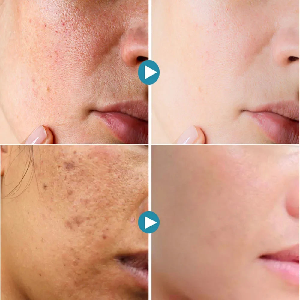 Revitalize Skin Fruit Acid Peeling Gel Facial Cleansing Exfoliating Peeling Scrub Deep Clean Acne Blackhead Remove Face Cleanser