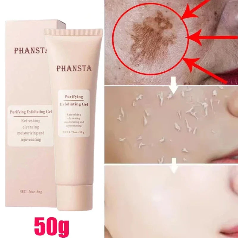 Revitalize Skin Fruit Acid Peeling Gel Facial Cleansing Exfoliating Peeling Scrub Deep Clean Acne Blackhead Remove Face Cleanser