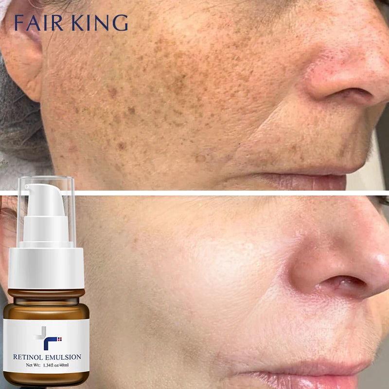 Retinol Anti aging&Anti wrinkle Essence Firming&Moisturizing Fine Lines Facial Lotion Skin Care&Brightening&Repairing Cosmetics