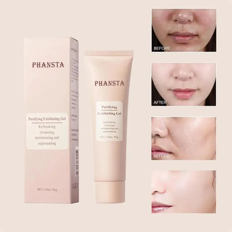 Revitalize Skin Fruit Acid Peeling Gel Facial Cleansing Exfoliating Peeling Scrub Deep Clean Acne Blackhead Remove Face Cleanser