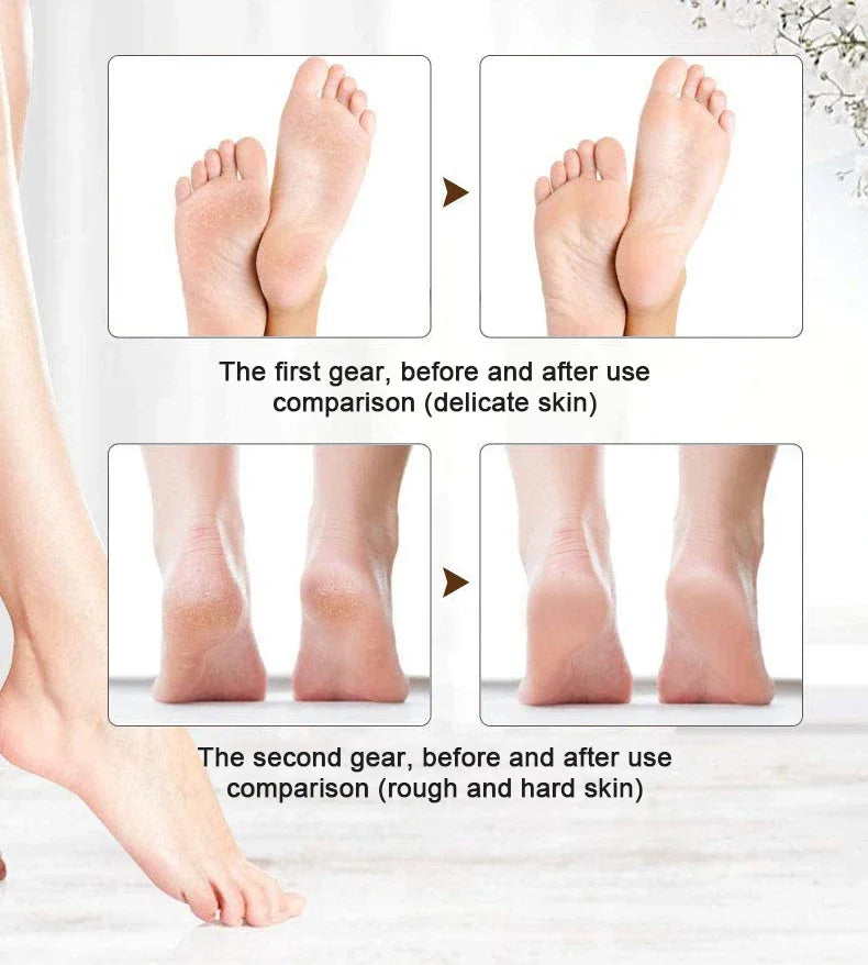 Electric Grinding Pedicure Tools Foot Sandpaper File for Heels Professional Foot Care Tool Dead Hard Skin Callus Remover Tool