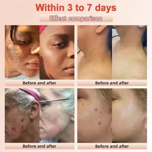 Revitalize Skin Fruit Acid Peeling Gel Facial Cleansing Exfoliating Peeling Scrub Deep Clean Acne Blackhead Remove Face Cleanser