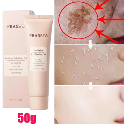 Revitalize Skin Fruit Acid Peeling Gel Facial Cleansing Exfoliating Peeling Scrub Deep Clean Acne Blackhead Remove Face Cleanser