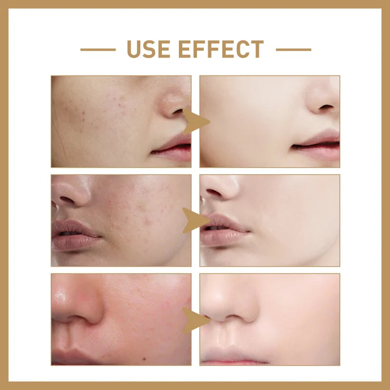 Rice Powder Toner 77.78% Korea Glow Essence with Niacinamide Hydrating for Dry Skin Facial Skin Care Brighten Improve Fine Line