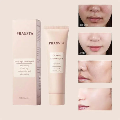 Revitalize Skin Fruit Acid Peeling Gel Facial Cleansing Exfoliating Peeling Scrub Deep Clean Acne Blackhead Remove Face Cleanser